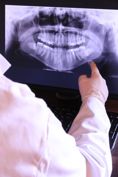 Best Broken Tooth Emergency  in Harveys Lake, PA